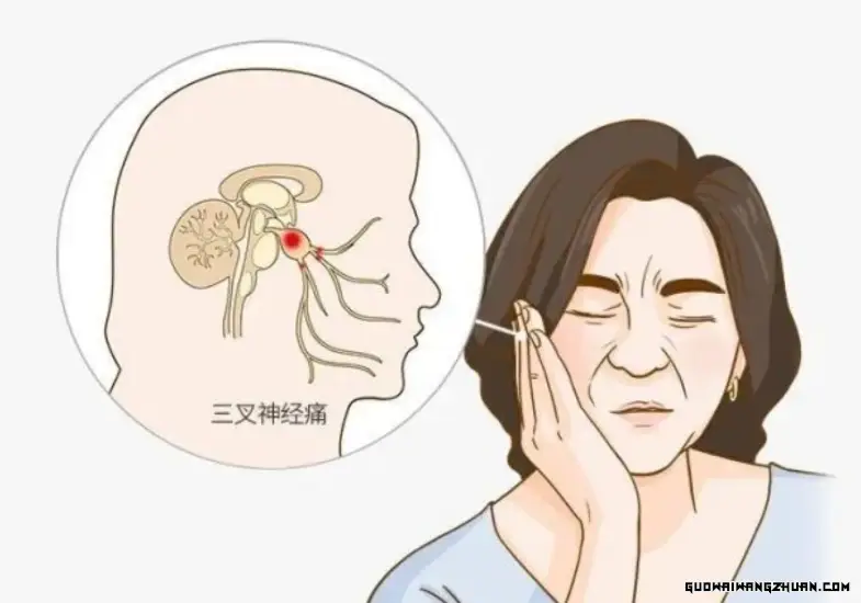 三叉神经痛怎么办？全面解析治疗方法，助你重拾健康生活